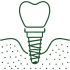 implant-planning